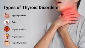 Thyroid Issues
